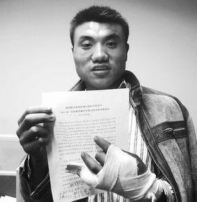 2009年,孙中界 (上海“钓鱼执法”事件当事人,这个来自外地的打工仔为了证明自己没有非法运营而自残手指)