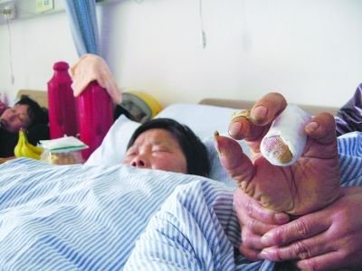 城管扯断卖菜老太手指 副局长称队员正常执法