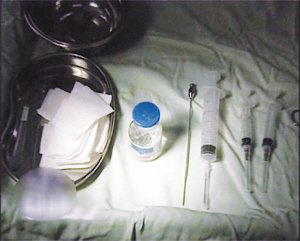 奥美定,把爱美的人“整”得好惨