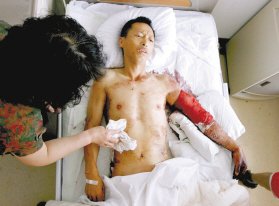 市民疑因拆迁问题遭数名统一着装男子砍伤
