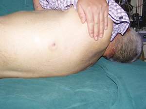 8旬老人家门口莫名中弹 警方监控取出子弹(图)