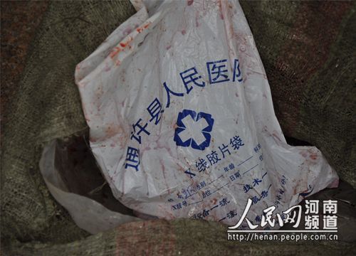 河南通许县两家医院倒卖产妇胎盘牟暴利