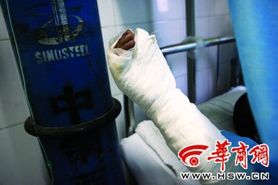 尹先生的伤情已得到控制 实习记者 叶原摄