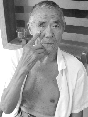 八旬老人因赡养纠纷被孙子打瞎右眼