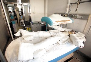 16岁少年打工全身烧伤70% 老板突然人间蒸发